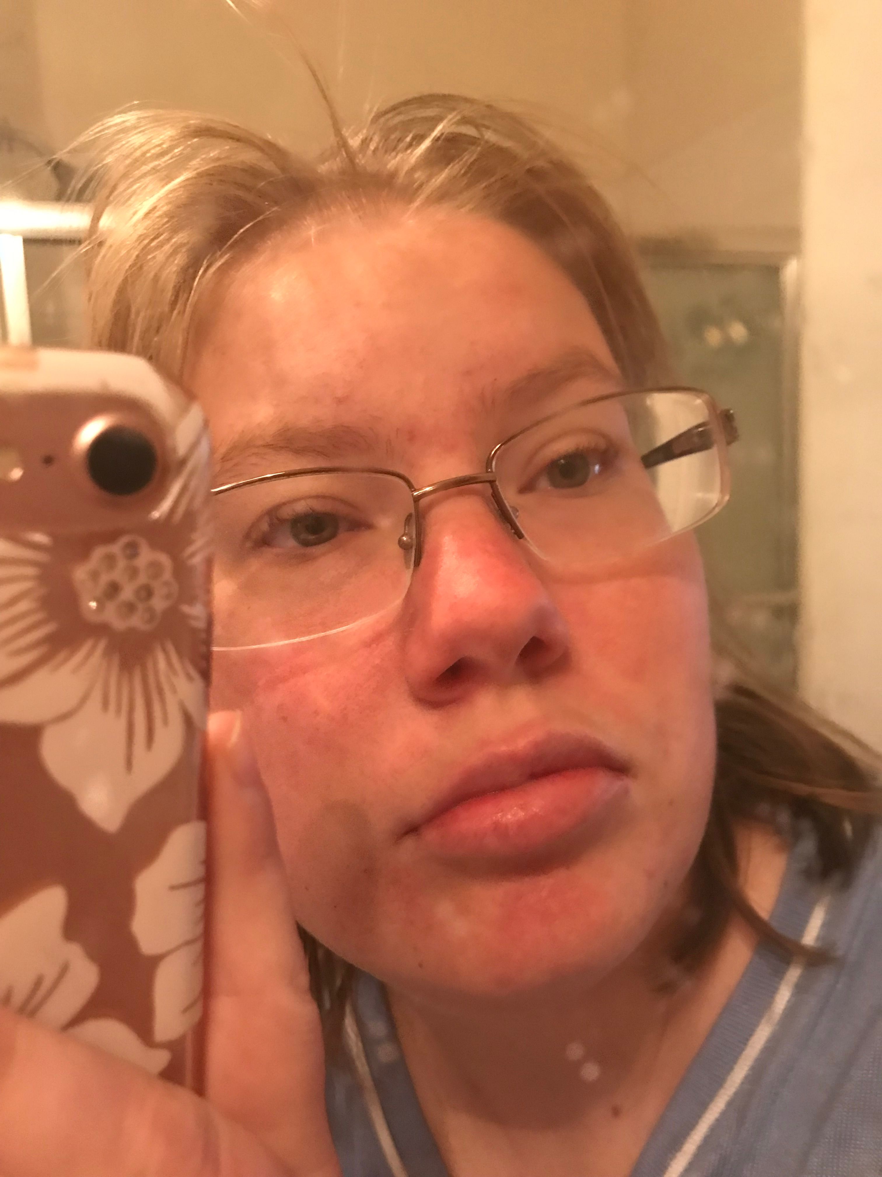 Exclusive: Brynn Woods' Hoyolab Leak Details - 5mniski
